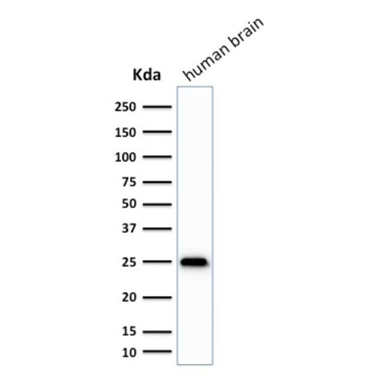 Western Blot - Anti-PGP9.5 Antibody [SPM575] (A250272) - Antibodies.com