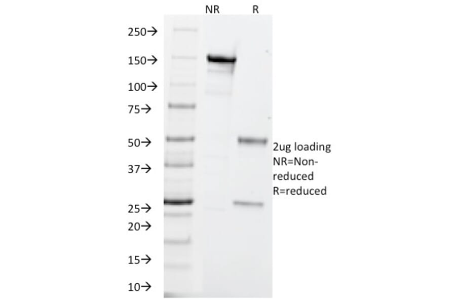 SDS-PAGE - Anti-PGP9.5 Antibody [SPM575] (A250271) - Antibodies.com