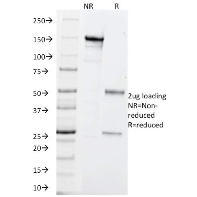 SDS-PAGE - Anti-PGP9.5 Antibody [SPM575] (A250271) - Antibodies.com
