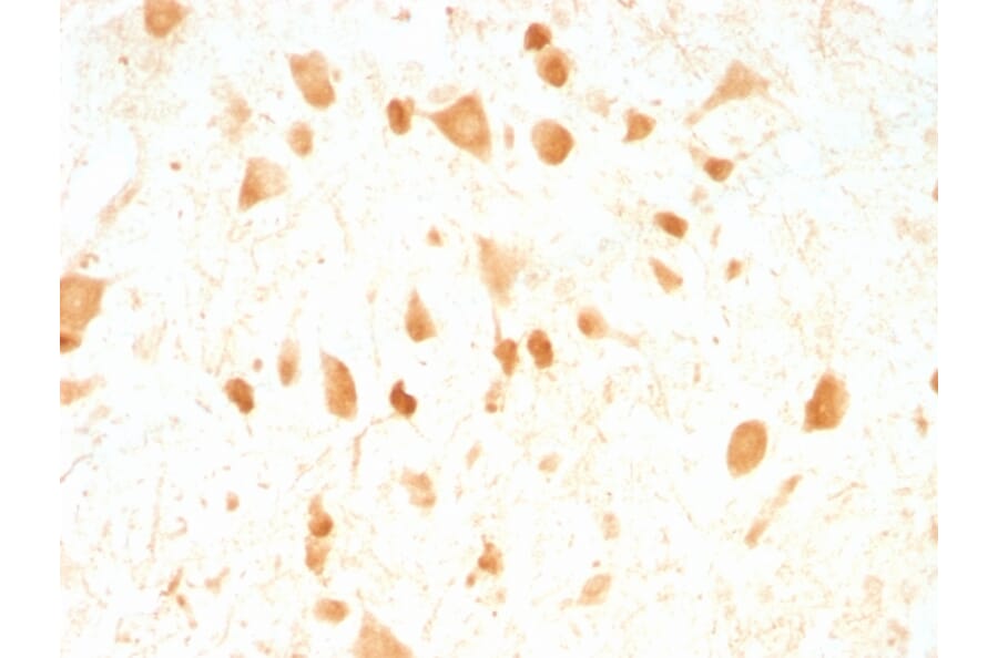 Immunohistochemistry - Anti-PGP9.5 Antibody [UCHL1/775] (A250272) - Antibodies.com