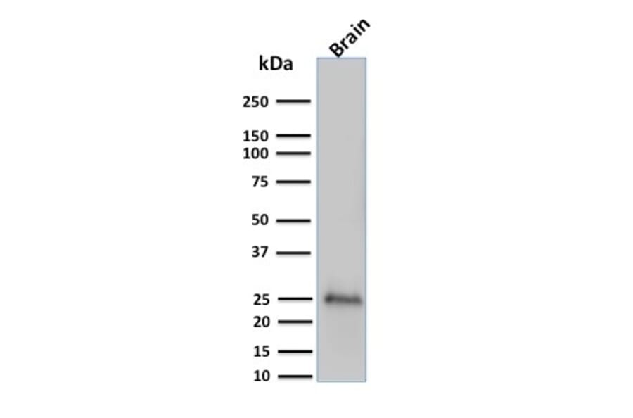 Western Blot - Anti-PGP9.5 Antibody [UCHL1/775] (A250273) - Antibodies.com