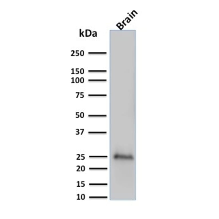 Western Blot - Anti-PGP9.5 Antibody [UCHL1/775] (A250273) - Antibodies.com