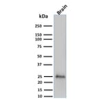 Western Blot - Anti-PGP9.5 Antibody [UCHL1/775] (A250273) - Antibodies.com