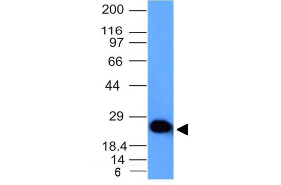 Western Blot - Anti-PGP9.5 Antibody [UCHL1/841] (A250274) - Antibodies.com