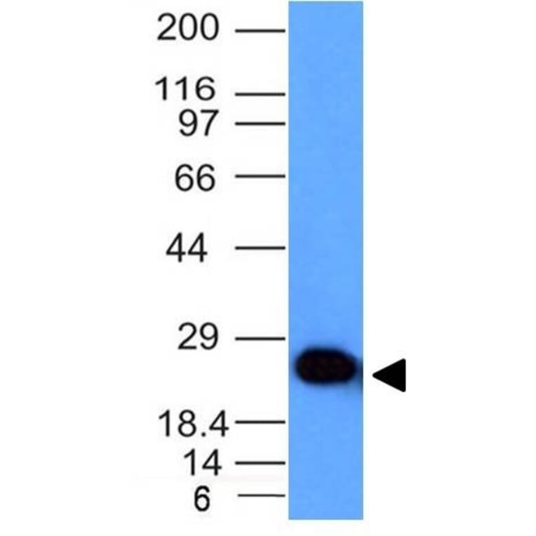 Western Blot - Anti-PGP9.5 Antibody [UCHL1/841] (A250274) - Antibodies.com