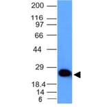 Western Blot - Anti-PGP9.5 Antibody [UCHL1/841] (A250274) - Antibodies.com