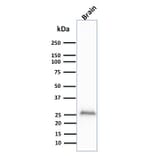 Western Blot - Anti-PGP9.5 Antibody [UCHL1/841] (A250273) - Antibodies.com