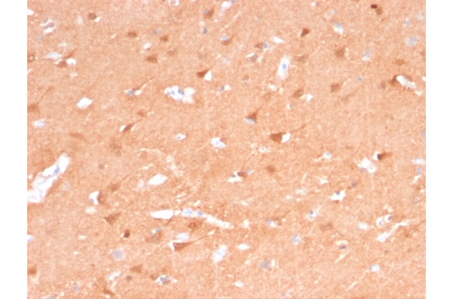 Immunohistochemistry - Anti-PGP9.5 Antibody [rUCHL1/775] (A250275) - Antibodies.com