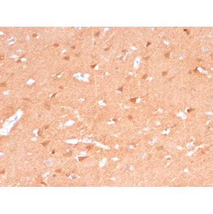 Immunohistochemistry - Anti-PGP9.5 Antibody [rUCHL1/775] (A250275) - Antibodies.com