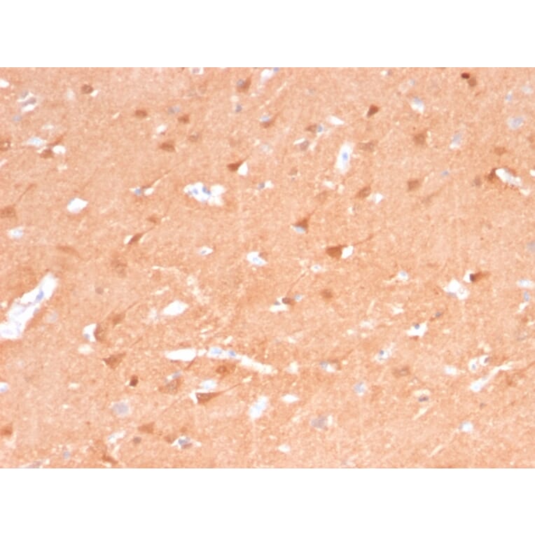 Immunohistochemistry - Anti-PGP9.5 Antibody [rUCHL1/775] (A250275) - Antibodies.com