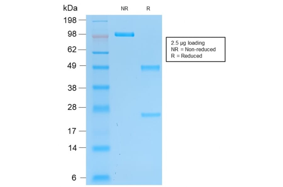 SDS-PAGE - Anti-PGP9.5 Antibody [rUCHL1/775] (A250275) - Antibodies.com