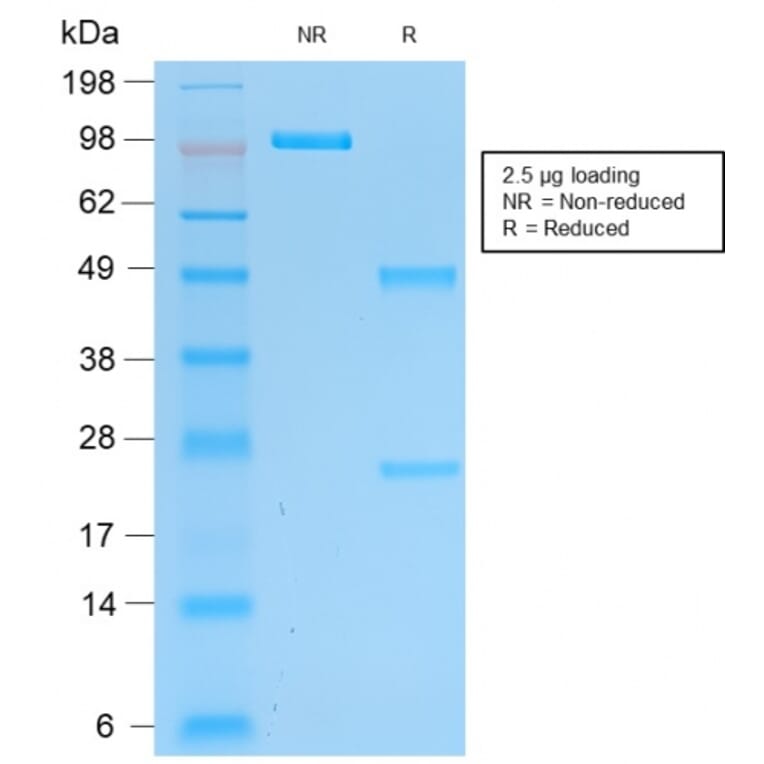 SDS-PAGE - Anti-PGP9.5 Antibody [rUCHL1/775] (A250275) - Antibodies.com