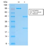 SDS-PAGE - Anti-PGP9.5 Antibody [rUCHL1/775] (A250275) - Antibodies.com