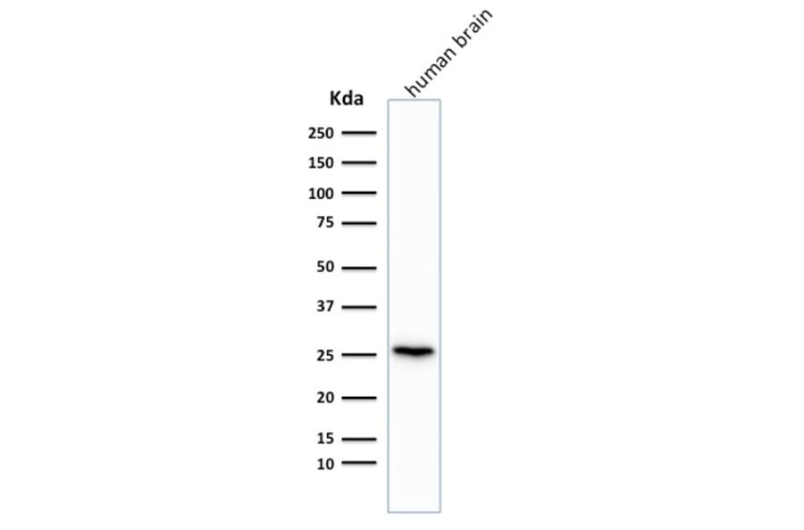 Western Blot - Anti-PGP9.5 Antibody [rUCHL1/775] (A250275) - Antibodies.com