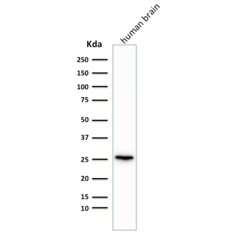 Western Blot - Anti-PGP9.5 Antibody [rUCHL1/775] (A250275) - Antibodies.com
