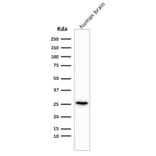 Western Blot - Anti-PGP9.5 Antibody [rUCHL1/775] (A250275) - Antibodies.com