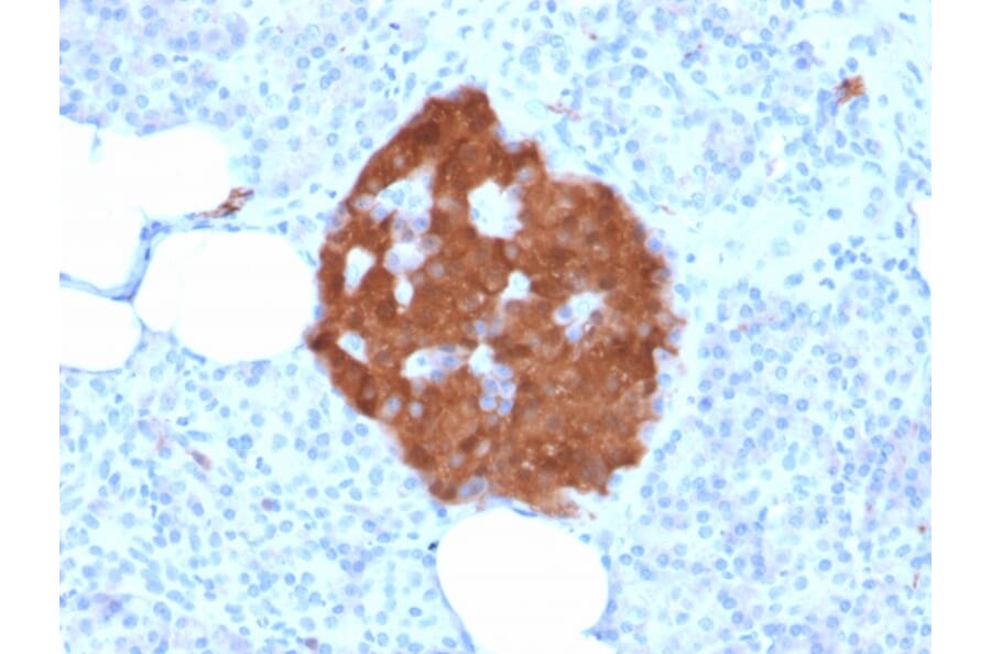 Immunohistochemistry - Anti-PGP9.5 Antibody [rUCHL1/775] (A250275) - Antibodies.com