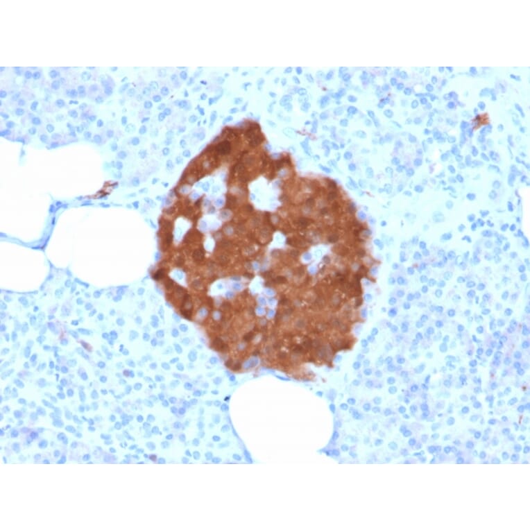 Immunohistochemistry - Anti-PGP9.5 Antibody [rUCHL1/775] (A250275) - Antibodies.com