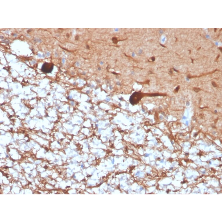 Immunohistochemistry - Anti-PGP9.5 Antibody [rUCHL1/4557] (A250276) - Antibodies.com
