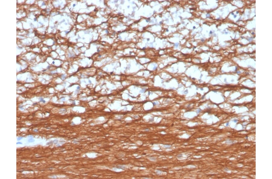Immunohistochemistry - Anti-PGP9.5 Antibody [rUCHL1/4557] (A250275) - Antibodies.com