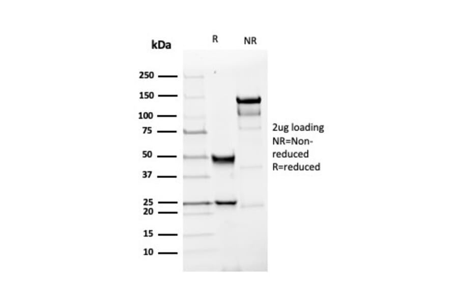 SDS-PAGE - Anti-PGP9.5 Antibody [rUCHL1/4557] (A250276) - Antibodies.com