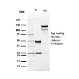 SDS-PAGE - Anti-PGP9.5 Antibody [rUCHL1/4557] (A250276) - Antibodies.com