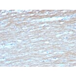 Immunohistochemistry - Anti-PGP9.5 Antibody [UCHL1/4558] (A250277) - Antibodies.com