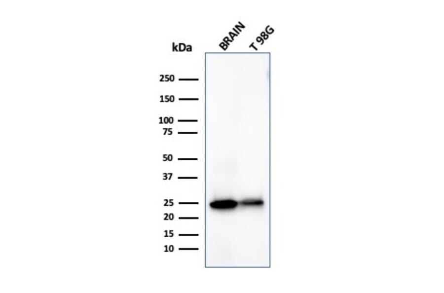 Western Blot - Anti-PGP9.5 Antibody [UCHL1/4558] (A250277) - Antibodies.com