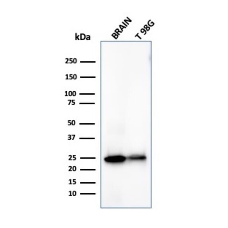 Western Blot - Anti-PGP9.5 Antibody [UCHL1/4558] (A250277) - Antibodies.com