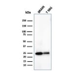 Western Blot - Anti-PGP9.5 Antibody [UCHL1/4558] (A250277) - Antibodies.com