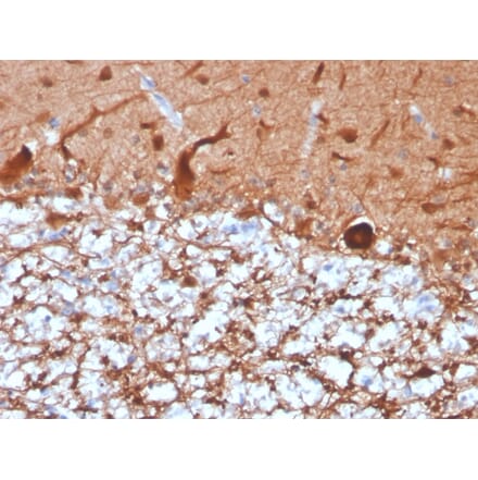 Immunohistochemistry - Anti-PGP9.5 Antibody [UCHL1/4556R] (A250278) - Antibodies.com