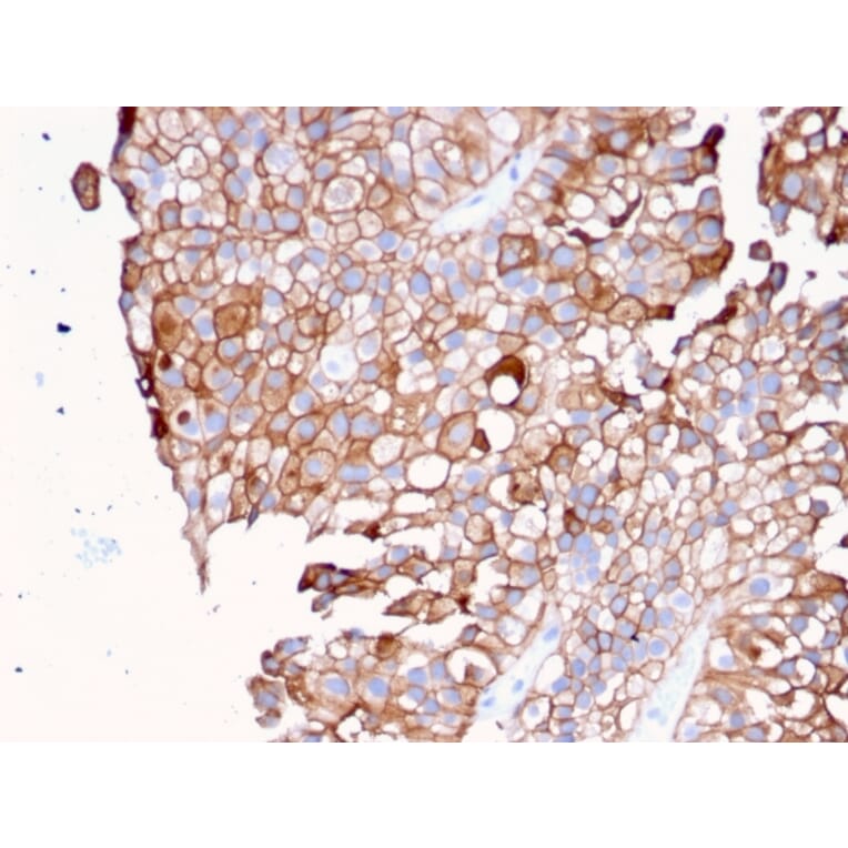 Immunohistochemistry - Anti-Uroplakin 1B Antibody [UPK1B/3081] (A250279) - Antibodies.com