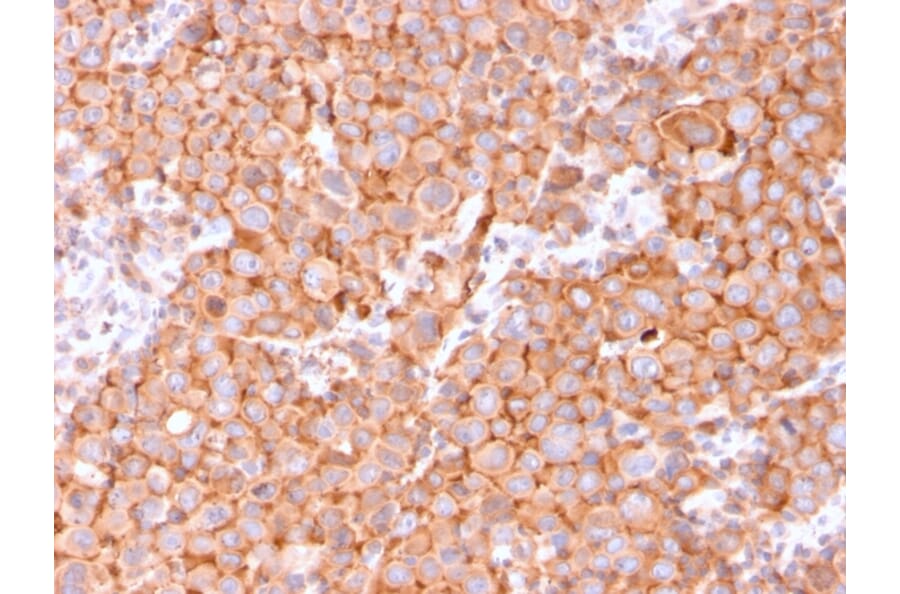 Immunohistochemistry - Anti-Uroplakin 1B Antibody [UPK1B/3081] (A250279) - Antibodies.com