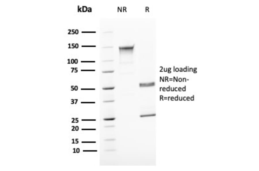 SDS-PAGE - Anti-Uroplakin 1B Antibody [UPK1B/3081] (A250279) - Antibodies.com