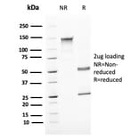 SDS-PAGE - Anti-Uroplakin 1B Antibody [UPK1B/3081] (A250279) - Antibodies.com