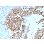 Immunohistochemistry - Anti-Uroplakin 1B Antibody [UPK1B/3102] (A250280) - Antibodies.com