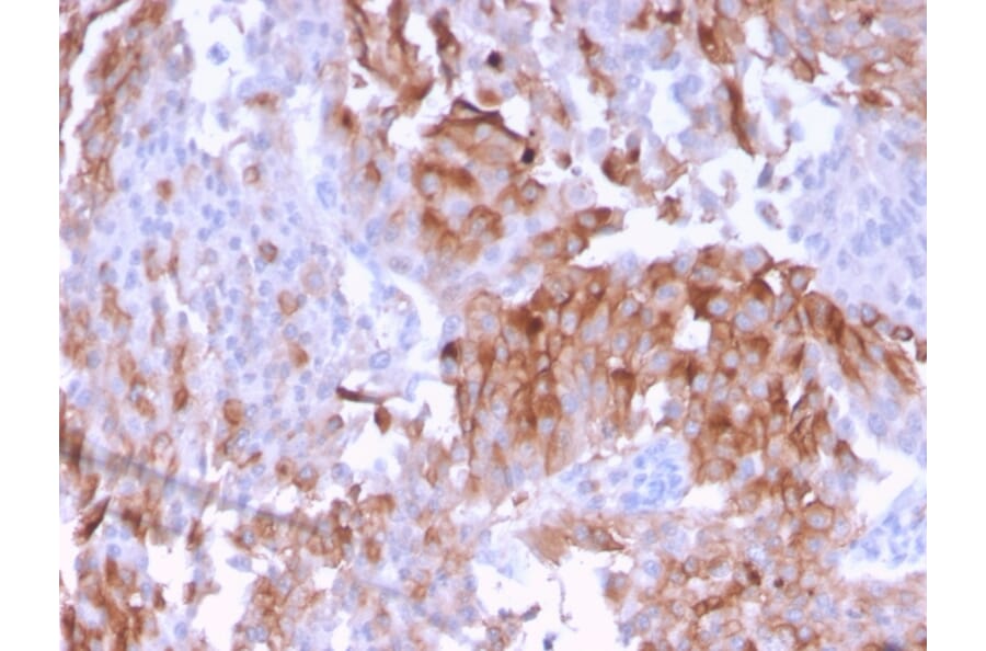 Immunohistochemistry - Anti-Uroplakin 1B Antibody [UPK1B/3102] (A250280) - Antibodies.com
