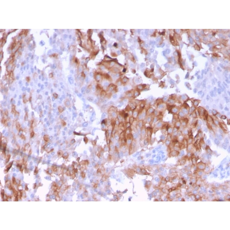 Immunohistochemistry - Anti-Uroplakin 1B Antibody [UPK1B/3102] (A250280) - Antibodies.com