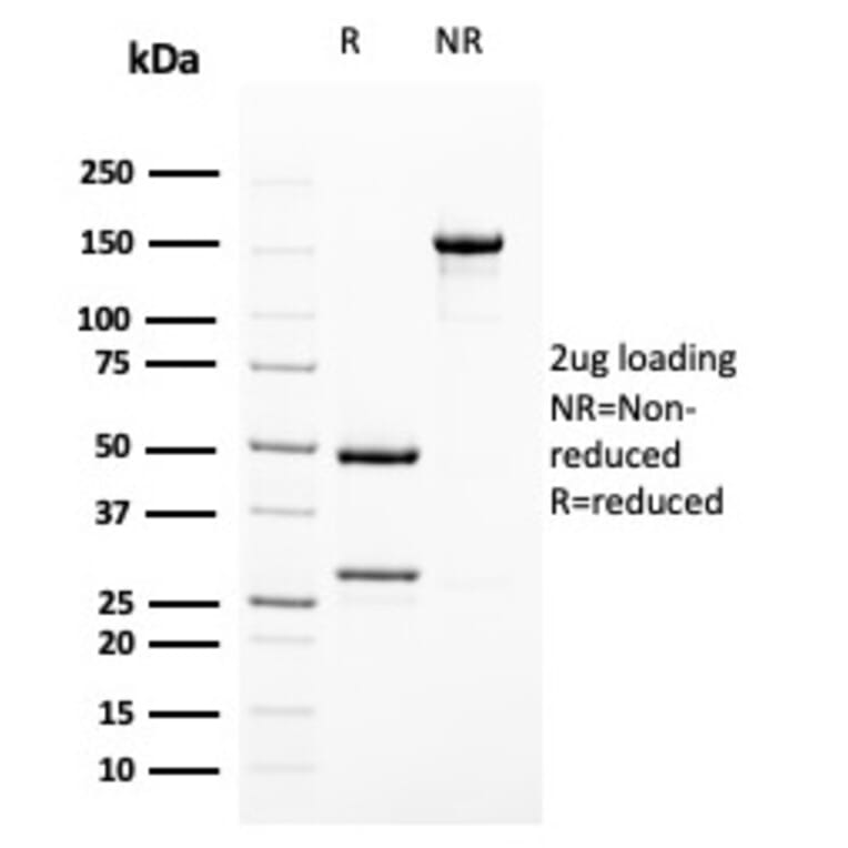 SDS-PAGE - Anti-Uroplakin 1B Antibody [UPK1B/3102] (A250280) - Antibodies.com