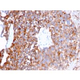 Immunohistochemistry - Anti-Uroplakin 1B Antibody [UPK1B/3273] (A250281) - Antibodies.com