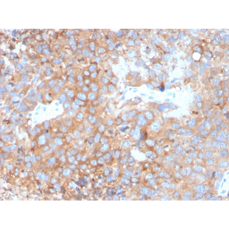 Immunohistochemistry - Anti-Uroplakin 1B Antibody [UPK1B/3273] (A253460) - Antibodies.com