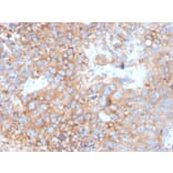Immunohistochemistry - Anti-Uroplakin 1B Antibody [UPK1B/3273] (A253460) - Antibodies.com