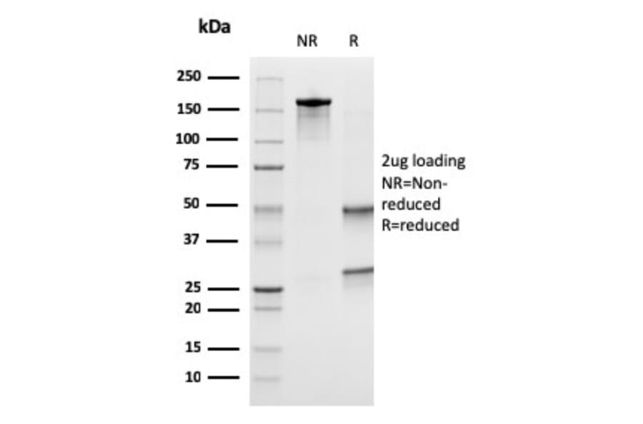 SDS-PAGE - Anti-Uroplakin 1B Antibody [UPK1B/3273] (A253460) - Antibodies.com