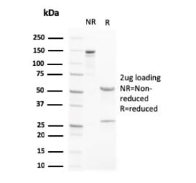 SDS-PAGE - Anti-Liver X Receptor beta Antibody [LXRB/2731] (A250282) - Antibodies.com