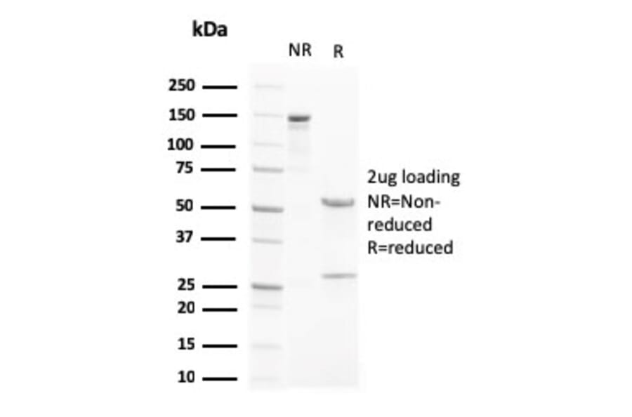 SDS-PAGE - Anti-Liver X Receptor beta Antibody [LXRB/2731] (A250282) - Antibodies.com