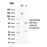 SDS-PAGE - Anti-Liver X Receptor beta Antibody [LXRB/2731] (A250282) - Antibodies.com