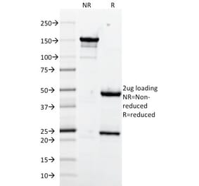 SDS-PAGE - Anti-VCAM1 Antibody [1.4C3] (A250284) - Antibodies.com