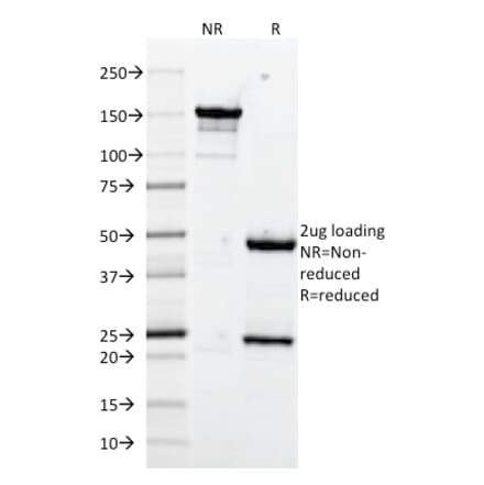 SDS-PAGE - Anti-VCAM1 Antibody [1.4C3] (A250284) - Antibodies.com