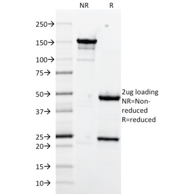 SDS-PAGE - Anti-VCAM1 Antibody [1.4C3] (A250284) - Antibodies.com