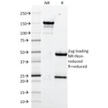 SDS-PAGE - Anti-VCAM1 Antibody [1.4C3] (A250284) - Antibodies.com